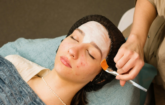 Anti Acne Facial